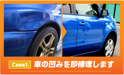 車の凹みを即修理します